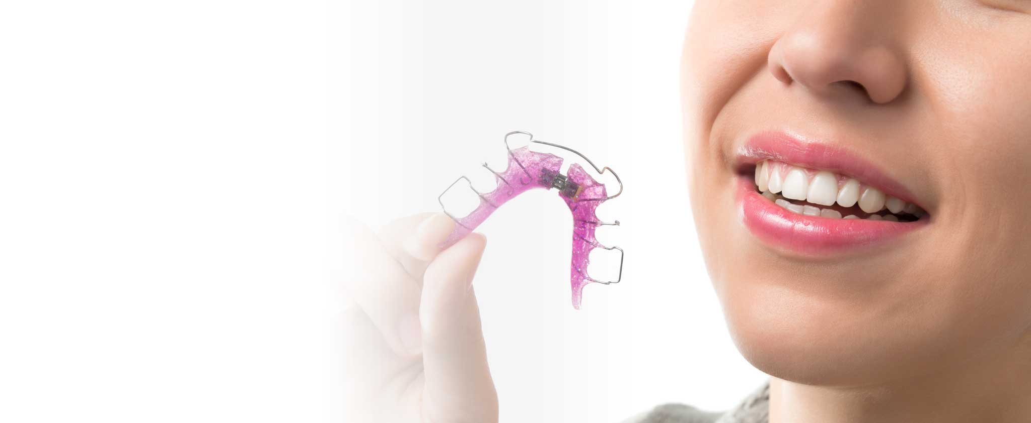 Removable Braces Teeth In Line